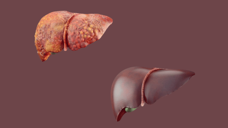 7 Silent Signs Your Liver Is Full of Toxins