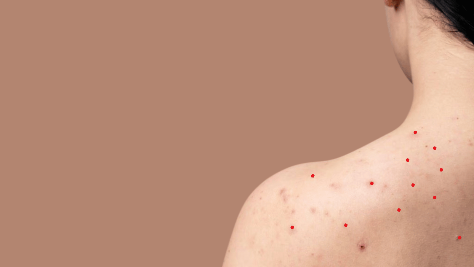 Red Spots on the Skin: Causes, Symptoms, and Treatment